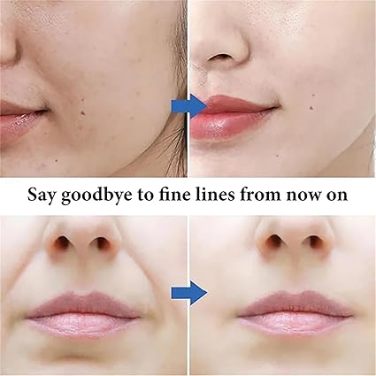 Spot Fading Urea Cream, Milkydeck Spot Fading