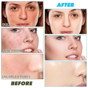 Turmeric Kojic Acid Exfoliating Cleansing Pads